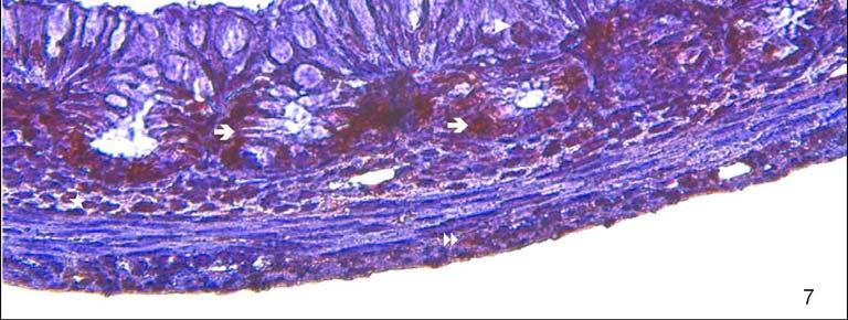 Resim 7: 1 günlük grupta PCNA tutulumu değerlendirildiğinde, bezlerin bazalinde ( ) son derece yoğun olduğu gözlenirken, yüzey epiteli hücre çekirdeklerinde ( ), bağ