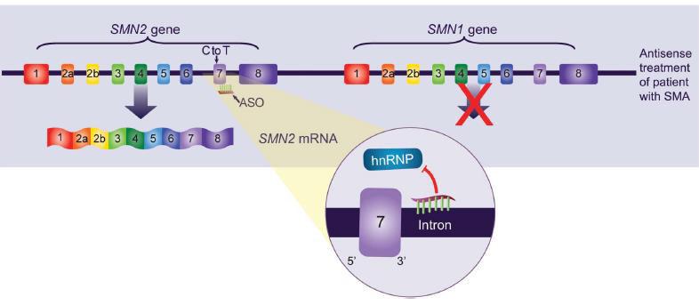 Antisens oligonükleotid olan Nusinersen, SMN2 genindeki pre-mrna ya bağlanarak