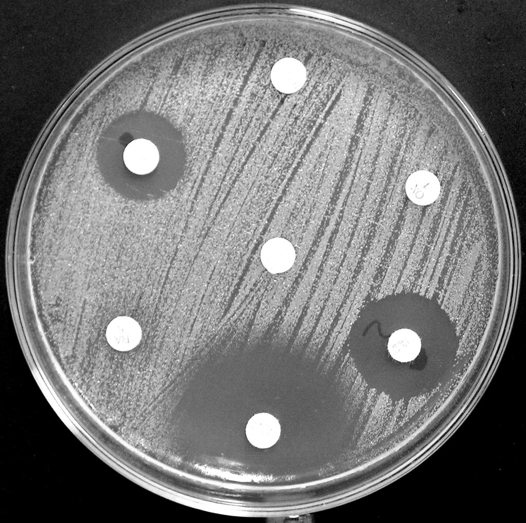 Besiyerlerinin yüzeyi kuruduktan sonra antibiyotik solüsyonları emdirilmiş ticari diskler yerleştirilmiştir. Kullanılan diskler, disk içerikleri tablo 8 de verilmiştir.