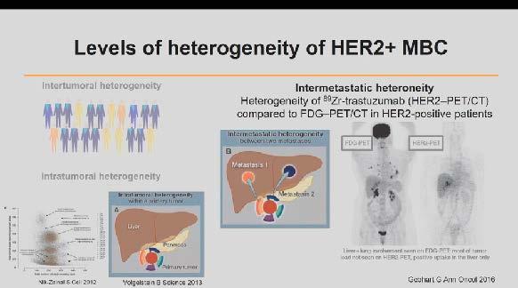 Intratümöral HER2 ekspresyonunda heterojenite anlaşılması 2.