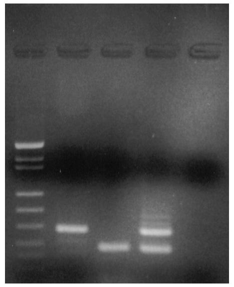1 2 3 4 5 Fig. 1: Nested amplifikasyon ürünlerinin %3 agaroz jel elektroforezi ile görüntülenmesi 1. DNA Moleküler Ağırlık Markır 2.