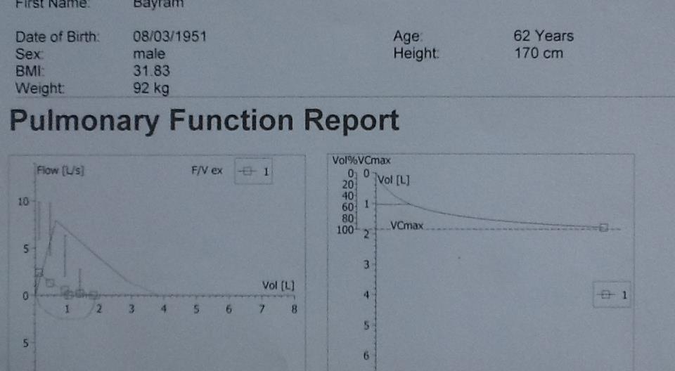 PRED ACTUAL % PRED FVC 3,84 1,81 47