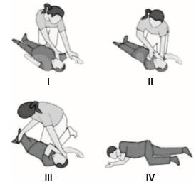 18. Resimde görülen uygulama hangi pozisyonun veriliş aşamalarını göstermektedir? A) Şok pozisyonu B) Koma pozisyonu C) Alt-çene pozisyon D) Baş-çene pozisyonu 19.