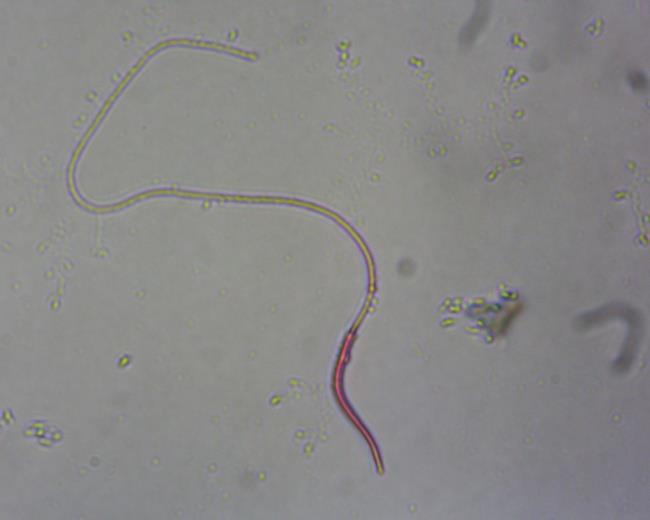 3.2.2.4.Vitalite Ejekülattaki canlı/ölü sperma oranının incelenmesi eosine boyama yöntemi (Kadıoğlu, 2011) ile yapıldı.