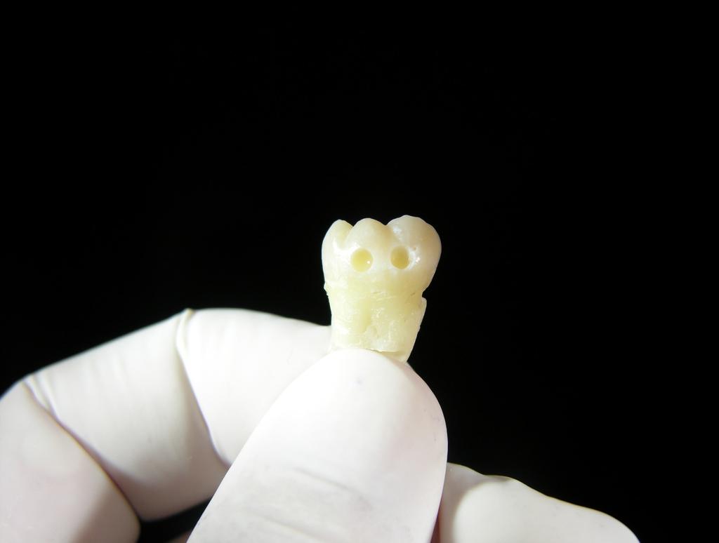 65 3.3. Dişlerin ve Bağlantı Yüzeylerinin Hazırlanması Çalışmada kullanılacak dişler % 1 lik timol solusyonu içerisinde 1 hafta oda sıcaklığında bekletilerek dezenfekte edildi.