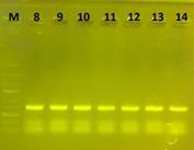 Şekil 16. Farklı QD konsantrasyonlarında L g DNA sı (5,5 ng) kullanılarak 30 döngü ile gerçekleştirilen PCR çalışmasının agaroz jel elektroforezi görüntüsü.