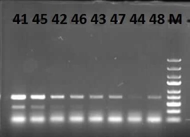 Şekil 19. 0,6 nm AuNP varlığında ve yokluğunda dubleks PCR verimine etkisini gösteren agaroz jel elektroforezi görüntüsü. 41: E g DNA sından 132,8.