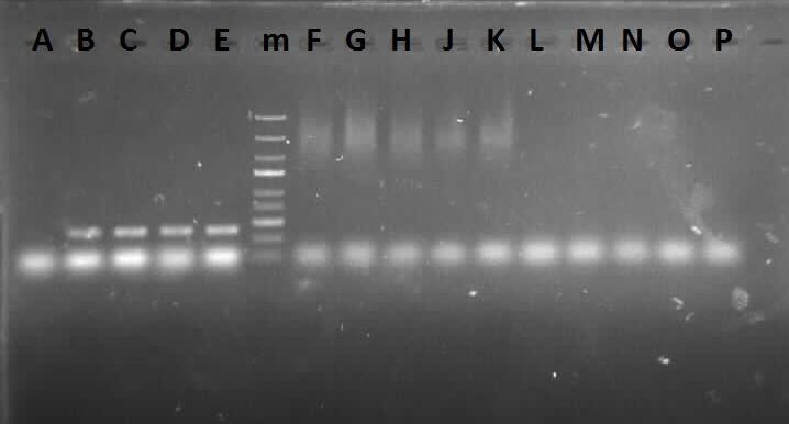 Şekil 24. QD varlığının (6,25 nm) farklı E g DNA miktarıyla yapay olarak kontamine edilen örneklerde PCR verimine etkisini gösteren agaroz jel elektroforezi görüntüsü.