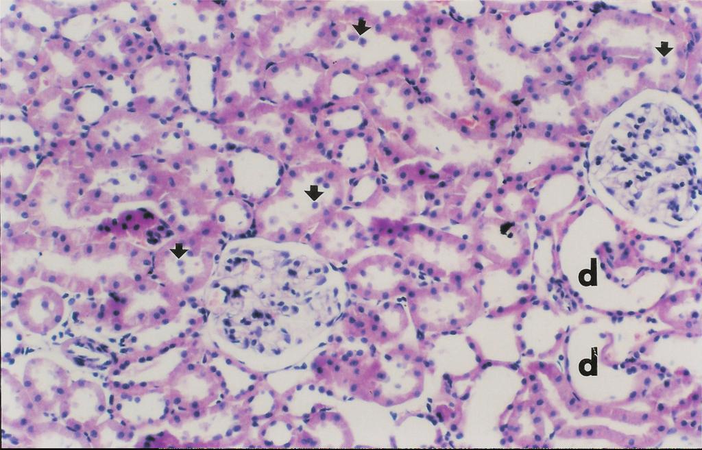 Tubulus lumenindeki epiteliyal hücrelerin dökülmesi (ok ile gösterilmiþtir) daha seyrek olarak gözükmektedir. (HE X 66).