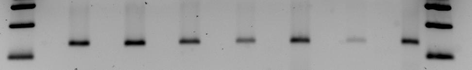 olmayan. HEK-293 negatif kontrol, MDA-MB231 pozitif kontrol.(marker; Mass Ruler DNA Ladder Low Range, Fermentas SM0383 tür.) Marker 100 bç ÖR. 36 ÖR. 37 ÖR. 38 ÖR. 39 ÖR. 41 ÖR. 20 ÖR.