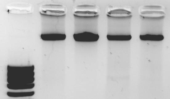 4. BULGULAR sfrp1 geninin promotör bölgesindeki genetik ve epigenetik değişikliklerin analizi için, SSCP, DNA dizi analizi ve metilasyon analizleri (metilasyon özgül PCR, bisülfit DNA dizi analizi)