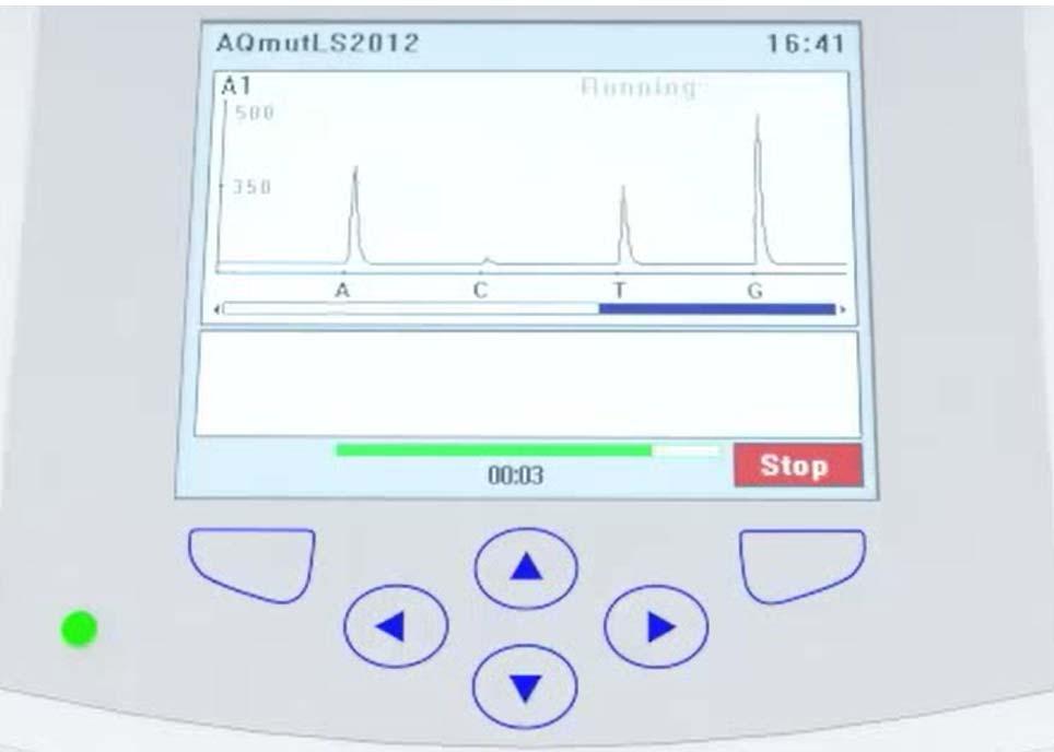 38 Şekil 3.8. Pyrosekans cihazının dizi analiz çıktısı 3.7. İstatistiksel analiz DNA sekans analizi PyroMark Q24 yazılımı ile yapıldı. Sonuçlar SPSS v.20.0 istatistik programı ile değerlendirildi.