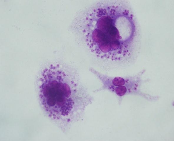 Amastigot A B Şekil 4. 3 Leishmania promastigotları ile enfekte olmuş makrofajlar (A. 24. saat, B. 48. saat, 100) 4.