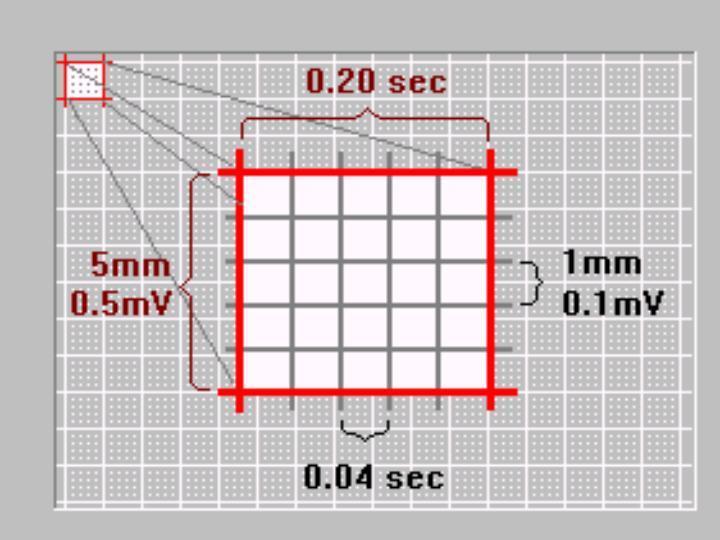 Kalbin hızının hesaplanması EKG, kağıt üzerine 25 mm/s hızda kaydedilir.