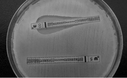 Şekil 1. Kolistin maruziyeti öncesi ATCC 19606 Acinetobacter baumannii suşu. Şekil 3. Kolistin maruziyeti sonrası ATCC 19606 Acinetobacter baumannii suşu. Şekil 2.