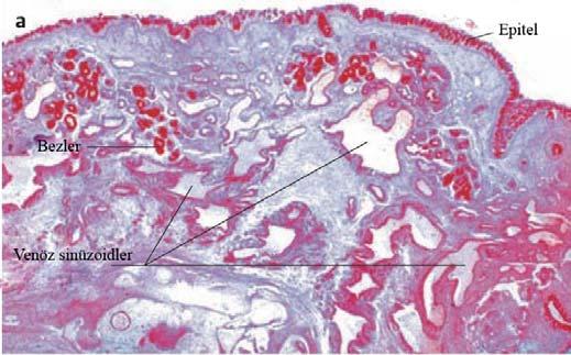Şekil 4: Nazal mukozada lamina propria yapısını gösteren histolojik kesit (Basic Otorhinolaryngology. Probst R., Grevers G., Iro W. Authors. Thieme Medical Publishers Newyork.