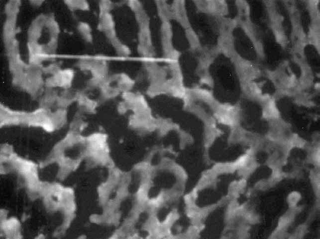 Tc-99m ile İşaretli Kurkumin Yüklü Katı Lipit Nanopartiküllerin Karaciğer-Dalak Sintigrafisindeki Rolü bu çalışmada özetlenen işaretleme prosedürün kullanımı ile birlikte 99m Tc-K-KLN nin in vivo