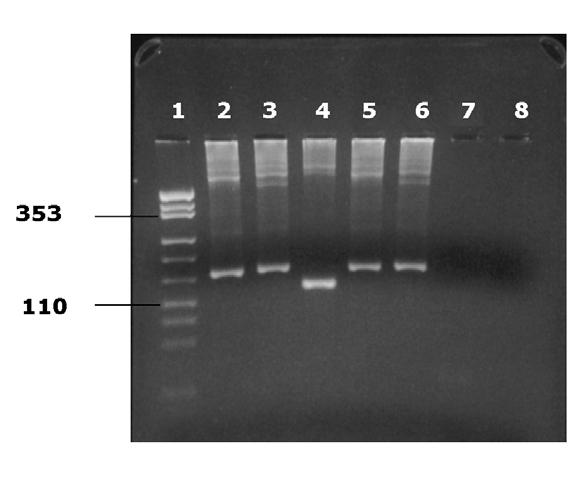 Fig. 2: %3 Agaroz jel elektroforezi 1. DNA MW Markır 2-6. t(14;18) (q32; q21) için pozitif örnek 7. MBR direk PCR için negatif kontrol 8.