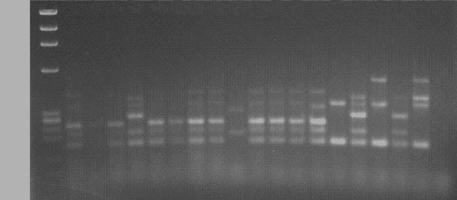 Akoğlu H, Zarakolu P, Altun B, Ünal S. 1353 1078 872 1 2 3 4 5 6 7 8 9 10 11 12 13 14 15 16 17 18 19 20 603 310 194 118 Şekil 1. Multipleks PCR yöntemi ile MRSA izolatlarının SCCmec tiplendirmesi.