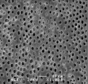 EndoVac grubunda kökün apikal üçlüsüne ait SEM görüntüsü Debris miktarı ve smear tabakası orta derecede, dentin