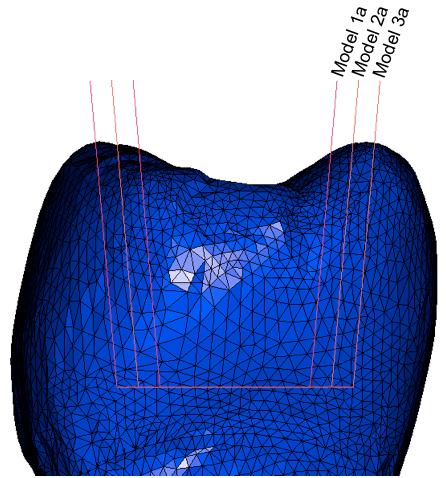 3.1.1. Kavite Taban Genişliğinin Değiştiği Modeller Model 1a: Mandibular sağ 1. molar dişte MOD kavite taban genişliğinin 3.5 mm, toplam kavite duvar açısının 10 olarak hazırlandığı model.