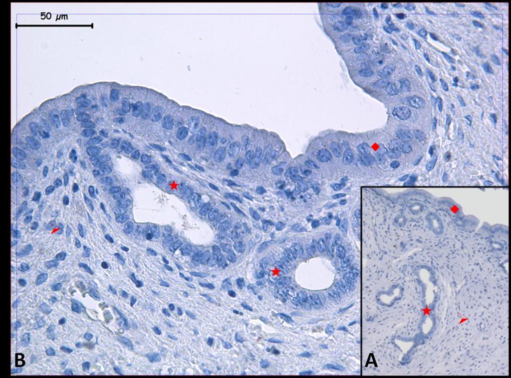 Fotoğraf 4A, B: Hipertermi uygulamasından bir saat önce NaCl+Katalaz uygulanan ve 6 saat sonra örneklerin alındığı gruba ait uterus dokusunda Kaspaz 8