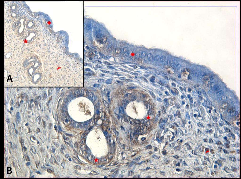 Fotoğraf 31A, B: Hipertermi uygulamasından bir saat önce NaCl+Katalaz uygulanan ve 6 saat sonra örneklerin alındığı gruba ait uterus dokusunda Hsp70