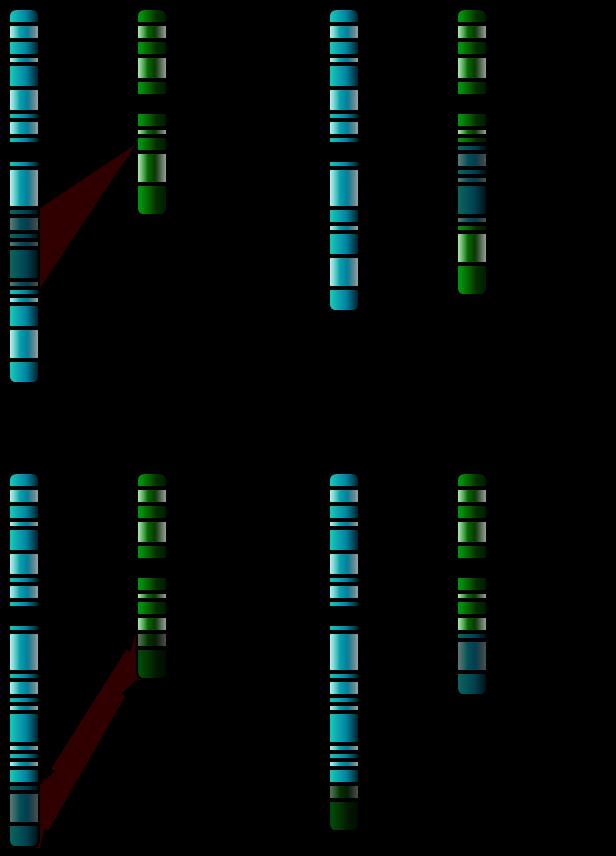 İki kromozom ile ilişkili hastalıklar Insersiyon Genetik materyal