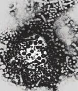Teşhis Amaçlı Moleküler Baskılama: Hepatit B Teşhisi Viral hepatit, dünya çapında yüz milyonlarca insanı etkileyen bir sağlık sorunudur.
