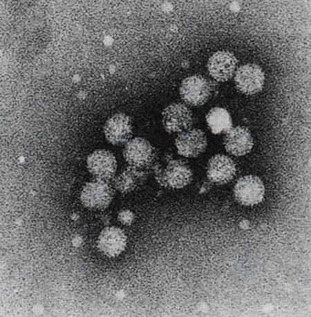 Hepatit C Virüsü: Tanıda