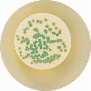 Su Mikrobiyolojisi Membran Filtrasyon Sistemleri Genel Analiz Malzemeleri Standart mikrobiyoloji laboratuvarı genel ekipman ve cihazları (bknz.