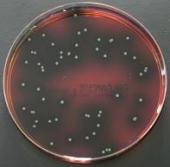 Şekil 4.1. Listeria spp. nin PALCAM Agar da Üreyen Kolonileri PALCAM Agarda koloni oluşturan Listeria spp. şüpheli örneklerden kanlı agar ve TSYE besiyerlerine ekim yapıldı.