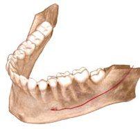 molarların köklerinin eksenel kesiti Tam dental ark: kök mand bular kanal l şk s Orta yapılı bir