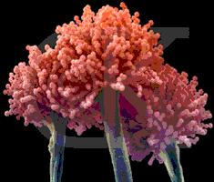 Şekil 2.1. Aspergillus parasiticus' un elektron mikroskobundaki görüntüsü [46]. Aflatoksinlerle ilk karşılaşma 1960 yılında görülmektedir.