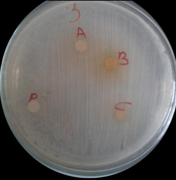 3.2. S. aureus ATCC-6538 bakteri suşu üzerinebitki ekstrelerinin antibakteriyel aktivitesi 10 µl Metanol ekstraktı 50 µl Metanol ekstraktı Ekstrakte edilen bitkiler: 1. Dilüsyon 10 µl 2.