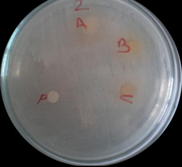 3.4. P. aeruginosa bakteri suşu üzerine bitki ekstrelerinin antibakteriyel aktivitesi 10 µl Metanol ekstraktı 50 µl Metanol ekstraktı Ekstrakte edilen bitkiler: 1. Dilüsyon 10 µl 2.