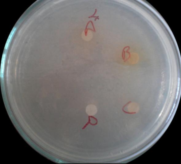 3.5. C. albicans ATCC- 14028 maya suşu üzerine bitki ekstrelerinin antifungal aktivitesi 10 µl Metanol ekstraktı 50 µl Metanol ekstraktı Ekstrakte edilen bitkiler: 1. Dilüsyon 10 µl 2.