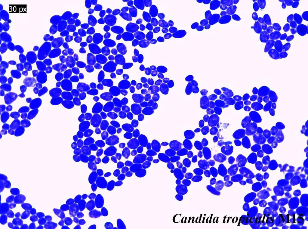 tropicalis, Candida lusitaniae, Candida krusei, Candida parapsilosis, Candida dubliniensis, Candida guilliermondii, Candida laurentii ve Candida glabrata [4,16]. 2.5.