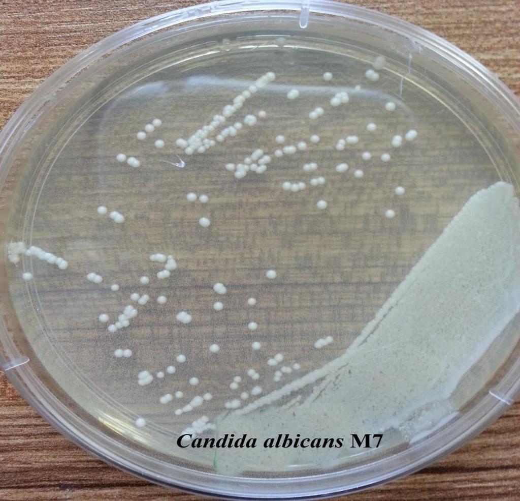 Resim 4.1.1. Candida albicans M7 izolatının PDA besiyerinde görüntüsü 4.2. İzolatların tanımlamaları PDA da üreyen kolonilerden izole edilen örneklerin önce gram boyaları yapılmıştır.