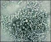 Hepatit B virüsü (HBV) Hepadnaviridae Karaciğer hücrelerini enfekte eder Dünya Sağlık Örgütü (WHO): Bilinen kanserojenler arasında ; 1. sırada tütün 2.