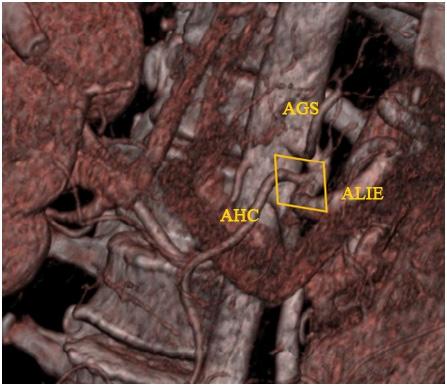 Şekil 3.19. Truncus hepatosplenicus.