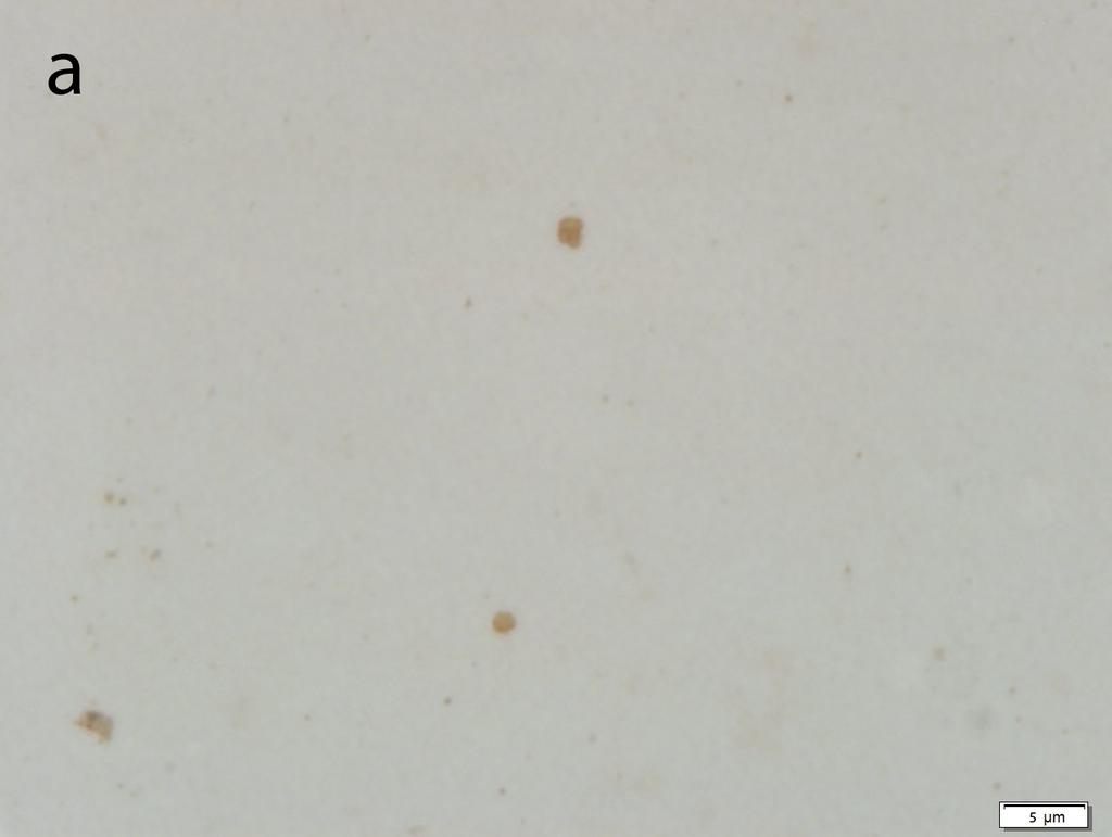 60 Detection of Brucella spp. in... swab samples, showed positive immunoreactivity for Brucella (Fig. 1a,b,c). These positive stained bacteria were observed as single or mostly in aggregates.