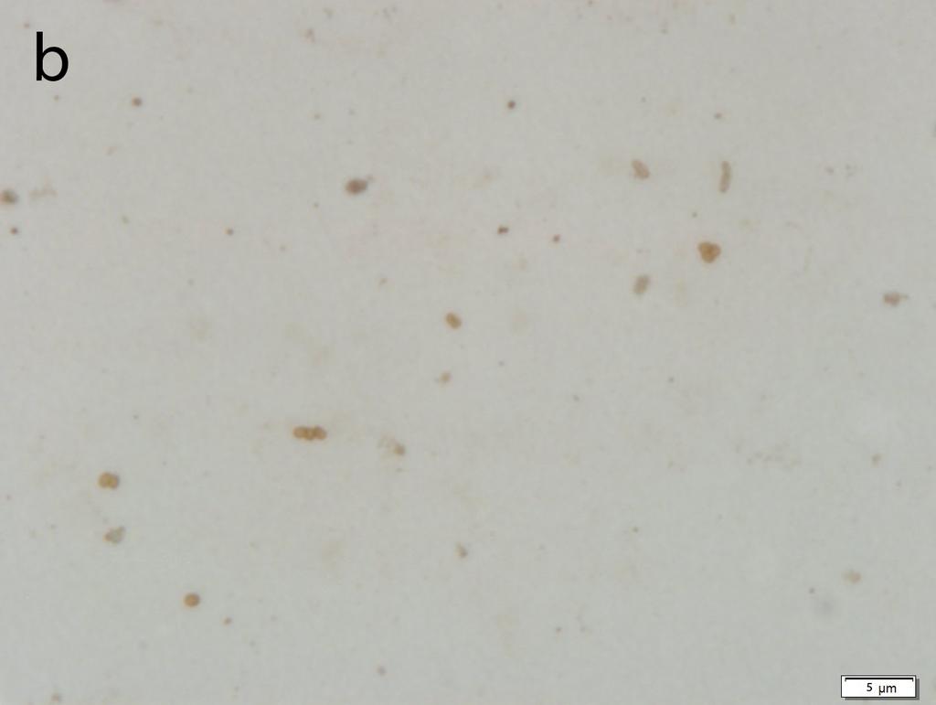 Brown stained coccobacilli shaped bacteria in smears prepared from the culture media were observed mostly in large groups and less as single or groups of 3 to 5 (Fig. ). All of the smears Fig 1.
