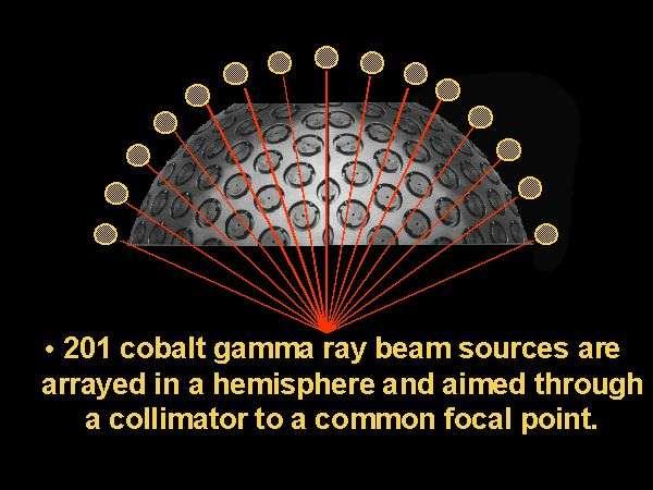 GAMMA KNIFE