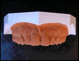 GİRİŞ Doğal dental estetiğin oluģturulmasında maksiller anterior diģler belirleyicidir.