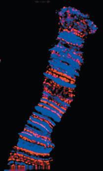 3.1 Politen kromozomlar Kromozom DNA sının