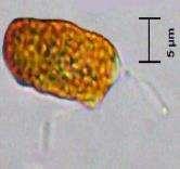 2. Anabaena