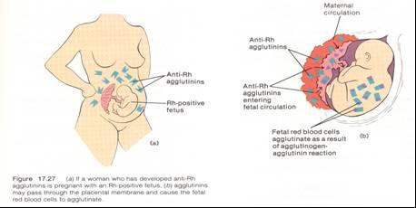 Plasenta yoluyla geçen antikorlar fetusun eritositlerini aglütine ederler.