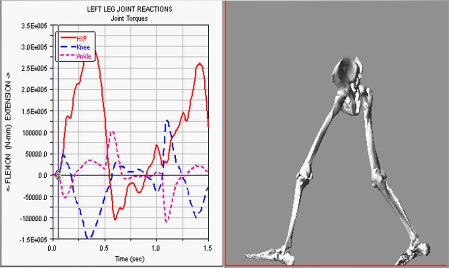 Yürüyüş Analizi (Gait Analysis) 19 Yürüyüş Analizi (Gait Analysis) 20 Yürüme analizi laboratuvarında hastanın yürüyüşü önce gözle bakarak ve video kayıtlarıyla değerlendirilir.