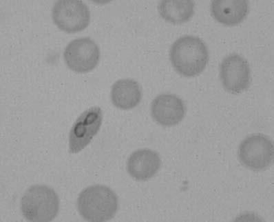 32 Ulutaş ve ark. Table 1. Some hematological and biochemical parameters in two dogs with atypical babesiosis.